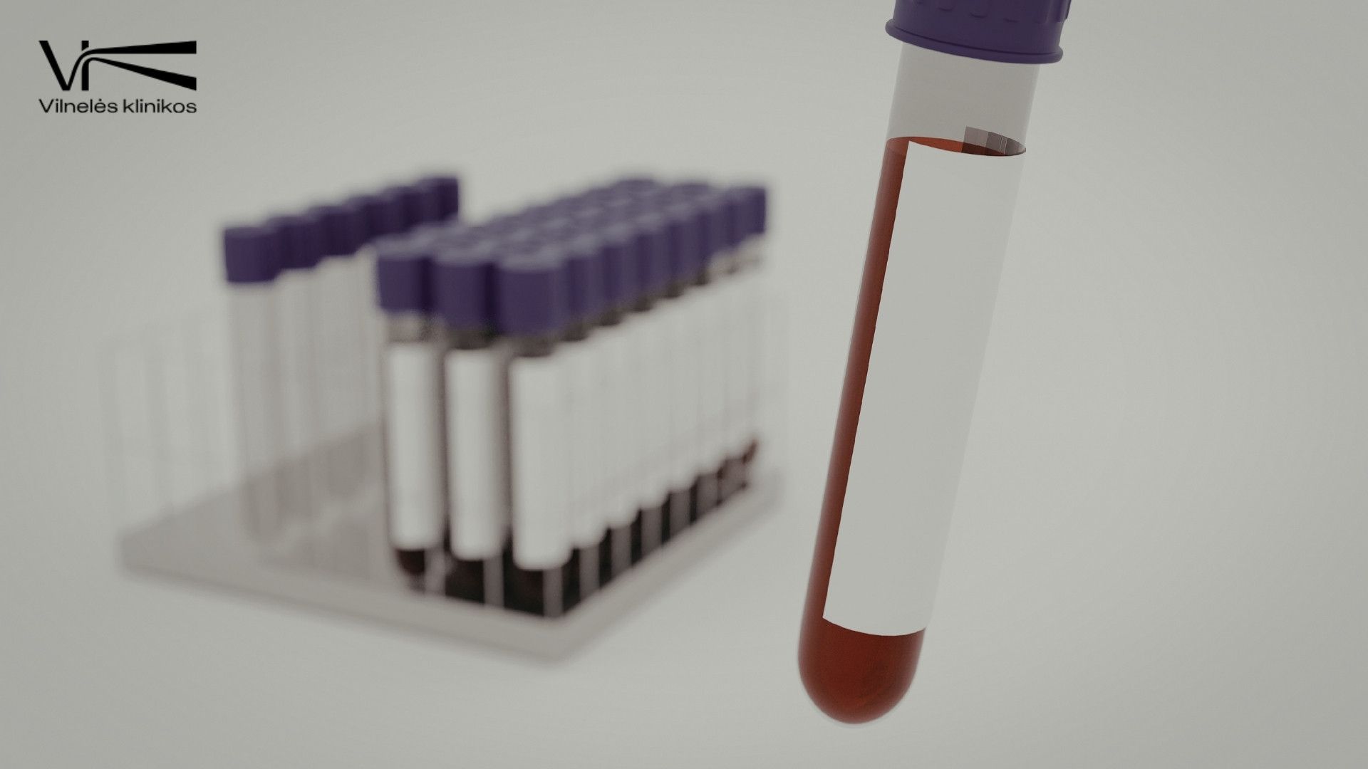 Kraujo tyrimai: ką gali parodyti bendras kraujo tyrimas?